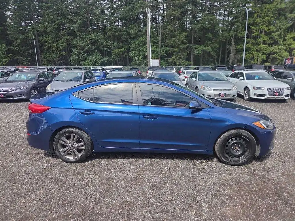 2017 Hyundai Elantra 2.0 SE A/T's photo